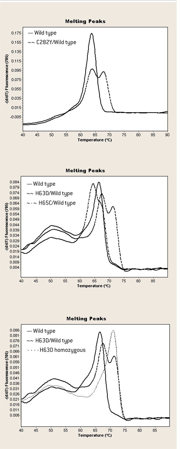 Diferenciacin entre los alelos salvajes y mutados del gen HFE mediante la temperatura de melting (Tm).