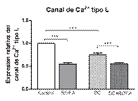 Expresi�n del canal de calcio tipo L (CCTL) en aorta.