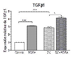 Expresi�n del factor de crecimiento transformante 1β (TGF-1β) en aorta.