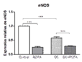Expresi�n la enzima �xido n�trico sintasa endotelial (eNOS) en aorta.