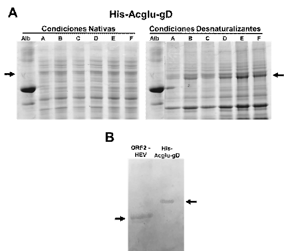 Expresi�n de la prote�na His-gD recombinante.