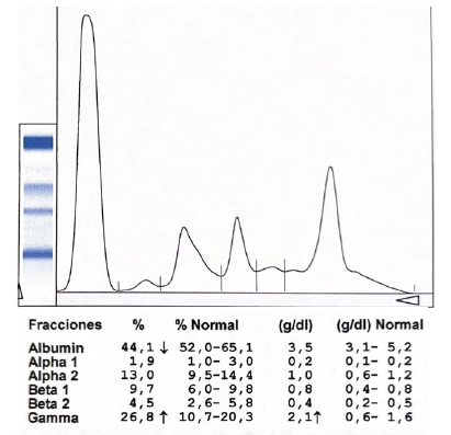 Pico monoclonal