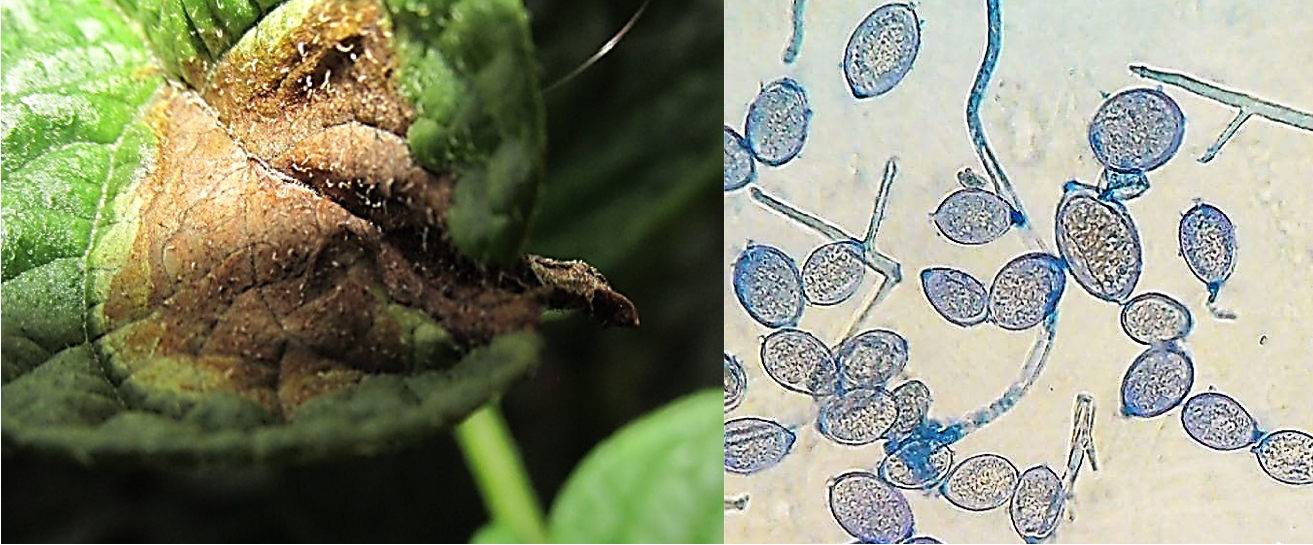 Tizn tardo. a) sntoma en hoja de papa. b) Imagen microscpica (40x) de esporangios, e hifas de Phytophthora infestans.