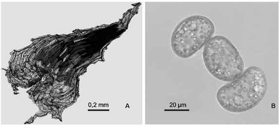 Fotograf&iacute;as de Blechnum malacothrix: A, escama rizom&aacute;tica. B, esporas en vista ecuatorial.