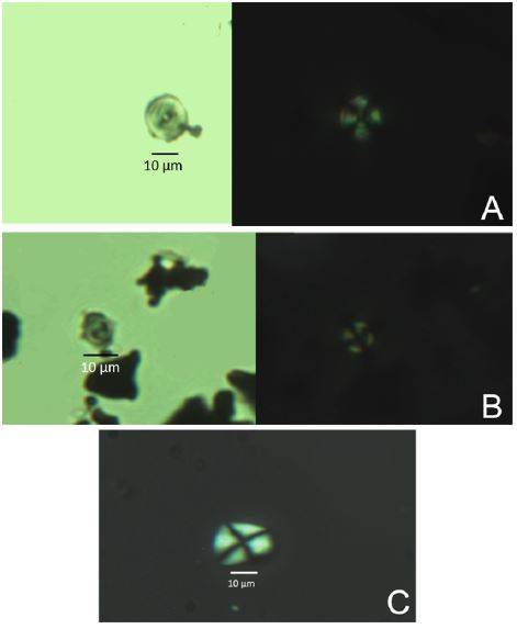 Microfósiles de gránulos de almidón de Z. mays de TPV1 (Sector I, Cuadrícula AII Nivel 13) observados a 60X: A) y B) gránulos de almidón observables con campo claro (a la izquierda) y luz polarizada (a la derecha); C) gránulo de almidón observable únicamente con luz polarizada. Figura en color en la versión en línea http://www.ojs.darwin.edu.ar/index.php/darwiniana/article/view/806/1160