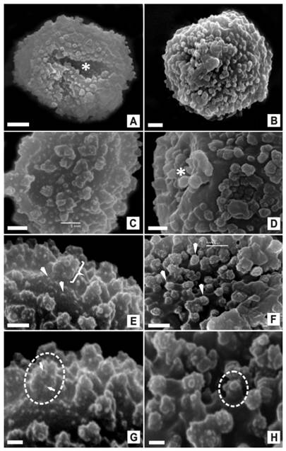 Esporas de Acrocladium auriculatum y Lepyrodon lagurus con MEB. A. auriculatum (A, C, E, G). A, vista proximal de una espora esferoidal, alete, de superficie ornamentada, en la que se observa cómo la espora se abolla sobre esta cara, posible leptoma (Asterisco). C, vista general de la superficie con procesos ornamentales en dos niveles. E, superficie de la espora en la que se observan procesos pequeños irregularmente distribuidos, en un nivel inferior (Flechas), y procesos de mayor tamaño, separados, en un nivel superior (Llave). G, detalle de un proceso baculado-gemado (Círculo), sobre el que se observa la ultra-escultura de pequeños procesos con forma de verrugas, gemas y gránulos (Flechas). Sobre el nivel inferior gránulos y verrugas distribuidos. L. lagurus (B, D, F, H). B, vista distal de una espora esferoidal, alete y superficie ornamentada. D, vista ecuatorial en la que se observa cómo la espora se abolla sobre una de las caras, posible leptoma (Asterisco). F, superficie de la espora en la que se observan procesos baculado-crestados, densamente distribuidos, sobre los que se visualizan pequeños procesos terminales (Cabezas de flecha). H, detalle de uno de los procesos baculado-crestado (Círculo) sobre el que se observa la ultra-escultura de procesos redondeados y agrupados en “conglomerados terminales”. Escalas: 2 µm (A, B); 1 µm (C, D, F, G); 0,5 µm (E, H).