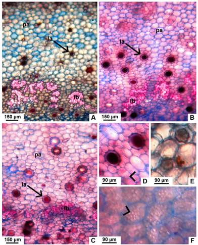 Detalle de la corteza interna, en corte transversal de tallo con crecimiento secundario de especies nativas de Jatropha. A-C, corteza de J. excisa, J. hieronymi y J. macrocarpa respectivamente, mostrando fibras perivasculares y laticíferos. D, detalle de los laticíferos de J. hieronymi, donde se observa la pared del mismo y el látex de color pardo oscuro. E, células de J. macrocarpa conteniendo cristales (drusas). F, parénquima reservante de almidón en J. macrocarpa. Abreviaturas: fb, fibras; la, laticífero; pa, parénquima. Con punta de flecha se señalan los granos de almidón. Figura en color en la versión en línea http://www.ojs.darwin.edu.ar/index.php/darwiniana/article/view/906/1210