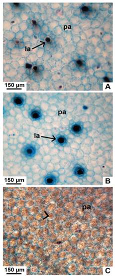Detalle de la médula parenquimática, en corte transversal de tallo con crecimiento secundario de especies nativas de Jatropha. A, médula de J. excisa, con laticíferos. B, médula de J. hieronymi con laticíferos. C, parénquima reservante de almidón en J. macrocarpa. Abreviaturas: la, laticífero; pa, parénquima. Con punta de flecha se señalan los granos de almidón. Figura en color en la versión en línea http://www.ojs.darwin.edu.ar/index.php/darwiniana/article/view/906/1210