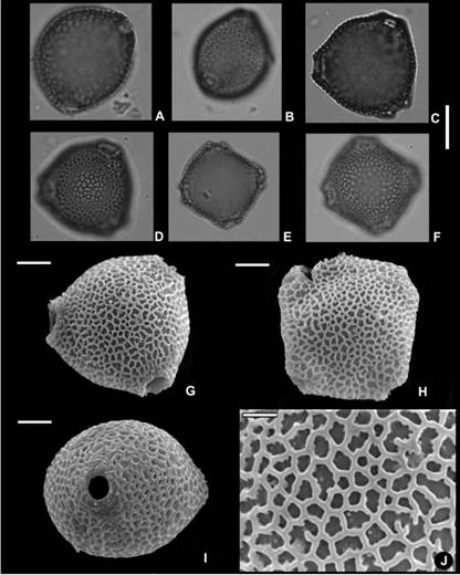 Granos de polen de Alibertia latifolia. A, grano en vista ecuatorial (MO). B, grano en vista ecuatorial, corte óptico mostrando el poro (MO). C, corte óptico, vista polar (MO). D, foco superior en vista polar (MO). E, corte óptico, vista polar de grano 4-porado (MO). F, foco superior en vista polar de grano 4-porado (MO). G, grano en vista polar 3-porado (MEB). H, grano en vista polar 4-porado (MEB). I, grano en vista ecuatorial mostrando el poro (MEB). J, detalle de la exina, mostrando los lúmenes del retículo heterobrocado (MEB). Escalas: A-F, 20 µm; G-I, 10 µm; J, 5 µm. De V. Dávalos 85a (CTES)