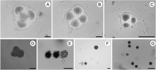 Sporads and viable/non-viable pollen grains of Lessingianthus. A-B, E:L. polyphyllus. D:L. brevifolius. F:L. teyucuarensis. G:L. pseudoincanus. A, normal tetrahedric tetrad. B, normal isobilateral tetrad. C, abnormal triad. D, abnormal triad. E, two viable pollen grains and one empty non-viable pollen grain (arrow). F, a small and non-viable pollen grain (arrow). G, an abnormal stained pollen grain of small size (arrow). Abbreviations: arrows = abnormal pollen grains. Scales: A-B, D, F = 10 μm; C = 30 μm; E, G = 50 μm.
