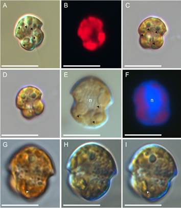 Light and fluorescence microscopy of Biecheleria brevisulcata. Strain LPCc022. Scale bars = 10 µm. A, cell in ventral view, note posterior flagellum. Black arrowheads show pyrenoids. B, fluorescent micrographs of the same cell, showing the chloroplasts. C, D, cells in ventral view showing cingular displacement and sulcus wider towards the distal end. E, cell in ventral view in deep focus showing a large nucleus (n) and pyrenoids (black arrowheads). F, fluorescent micrographs of a cell stained with calcofluor, showing the nucleus (n) and chloroplasts. G, cell showing a large stigma towards the anterior end of the sulcus (white arrowhead). H, I, different foci of the same cell in ventral tilted view revealing presence of thecal plates. Note stigma (white arrowhead). Color version at https://www.ojs.darwin.edu.ar/index.php/darwiniana/article/view/1138/1304