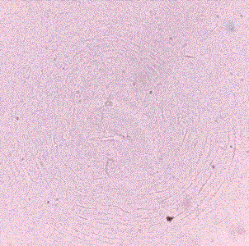 Corte perineal de Meloidogyne incognita extraida de agallas de raices. 
							