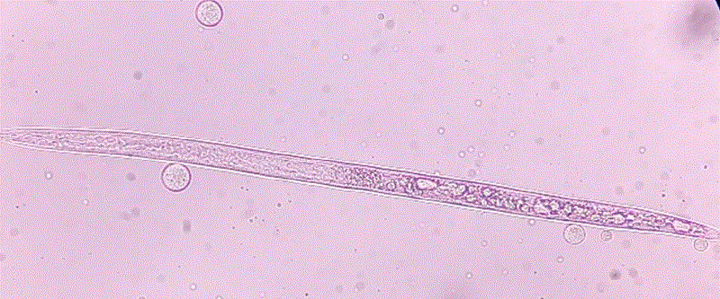 Meloidogyne incognita expuesto al tratamiento de Bacillus velezensis. 
 