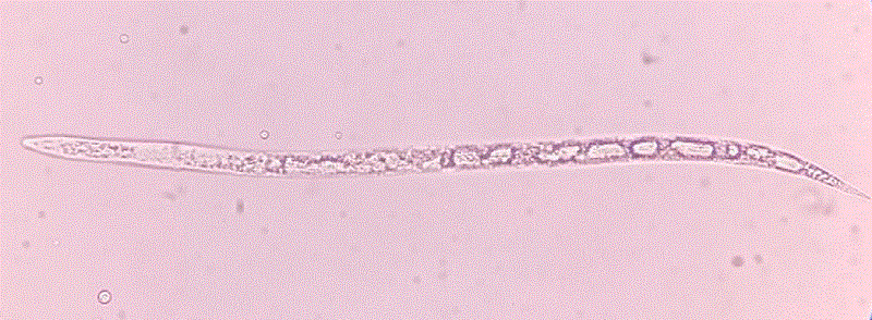 Meloidogyne incognita expuesto al tratamiento de Bacillus vallismortis.