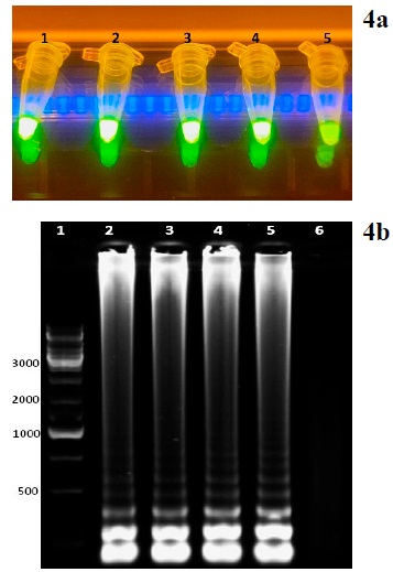 Visualizaci�n de reacci�n RT-LAMP. 4a. Visualizaci�n de reacci�n RT-LAMP en luz UV. 1-4) Muestras positivas, 5) Control negativo. 4b. Visualizaci�n de productos amplificados por RT-LAMP en gel de agarosa. 1) Marcador de peso molecular; 2-5) Muestras positivas; 6) Control negativo. 
								