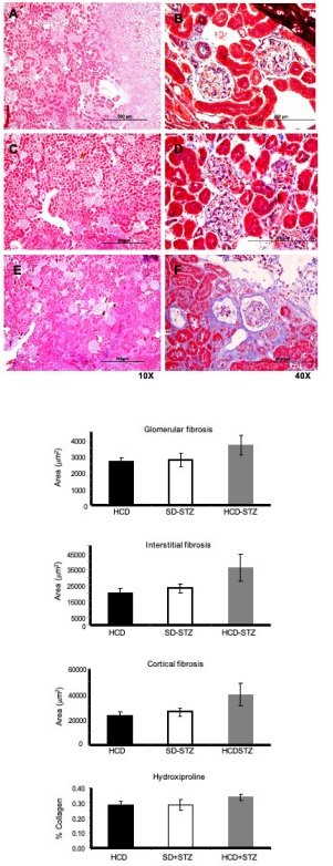 Fibrosis determination. Representative images of renal tissue Masson trichrome stained in each experimental group, where A and B correspond to HCD, C and D for SD-STZ and E and F to HCD-STZ animal groups. The panels of graphics indicate fibrosis determination (�m2) by computational morphometry in glomerular, interstitial, and cortical regions represented as mean � SD in each group of animals, similarly, the percentage of collagen proteins (hydroxyproline) is shown. 