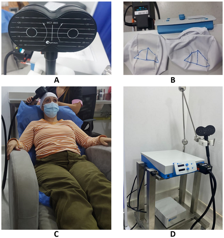 Figure-8 coil (A). Target marked on cap (B) rTMS therapy delivered (C) Image of the MagPro R20 magnetic stimulator (D).