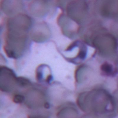 Imagen de muestra sanguínea infectada con el parásito T. cruzi.