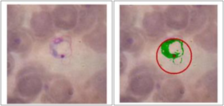 Detección del parásito T. cruzi. a) Ejemplo de parásito; b) resultado de detección.