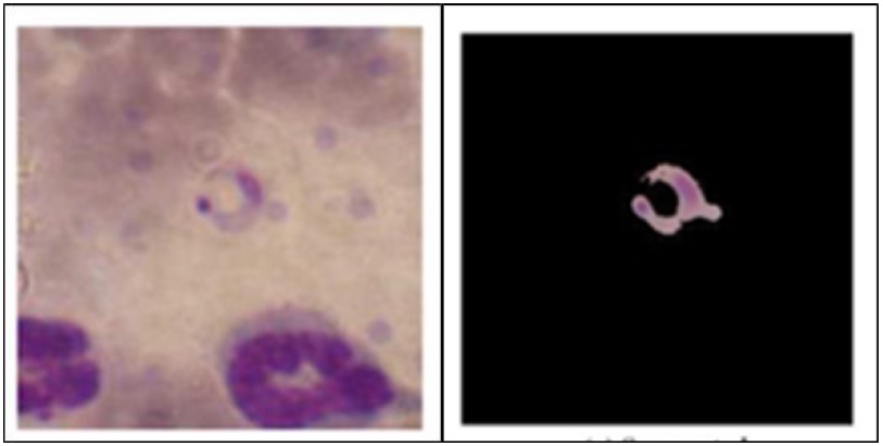 Detección del parásito T. cruzi. a) Ejemplo de parásito; b) resultado de segmentación.