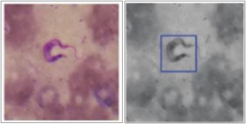 Detección del parásito T. cruzi. a) Ejemplo de parásito; b) resultado de detección.