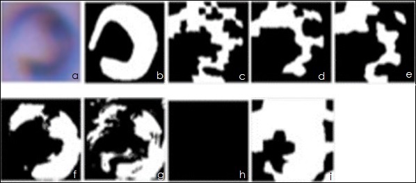 Ejemplo de la segmentación. a) Imagen original; b) segmentación manual; c), d) y e) segmentaciones con SVM y SÚPER pixeles de 50, 100 y 150, respectivamente; f) clasificación gaussiana; g) clasificación bayesiana; h) clasificación con método de Soberanis-Mukul (2012); i) clasificación con redes neuronales.