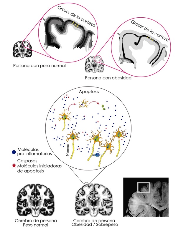 Posibles mecanismos neurobiolgicos que subyacen al sobrepeso y la obesidad.