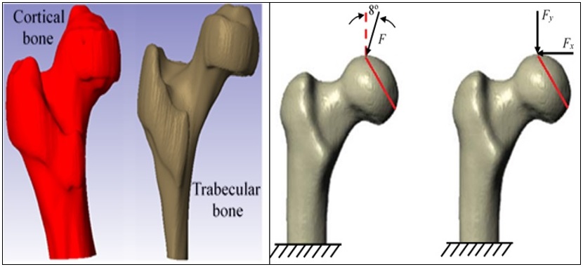 Configuraci�n del biomodelo con dos materiales, aplicaci�n de la carga y condiciones de contorno.