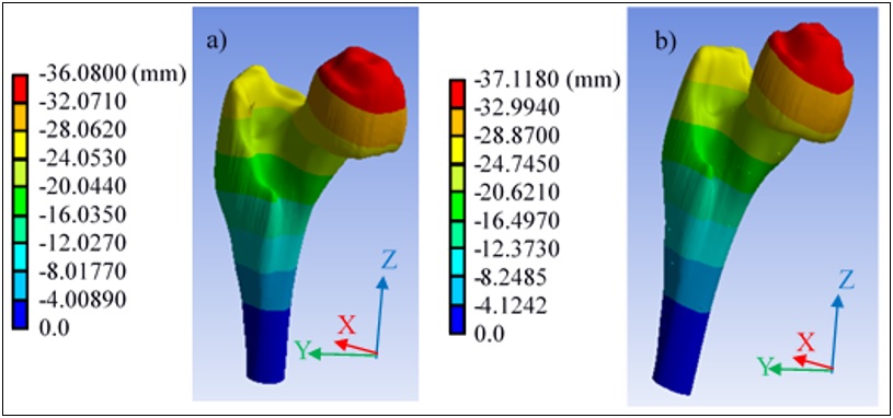 Desplazamiento total en hueso trabecular a) sin porosidad, b) con porosidad.