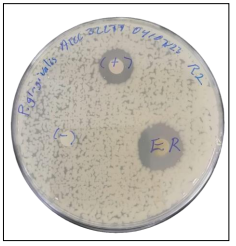 Halo de inhibici�n del aceite de romero contra P. gingivalis.