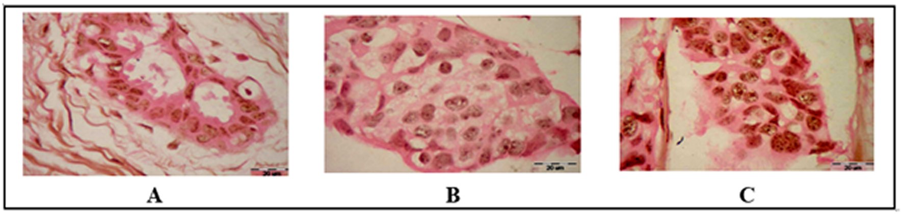 Histochemical Results of tested samples (Silver stain Bar=20 m).