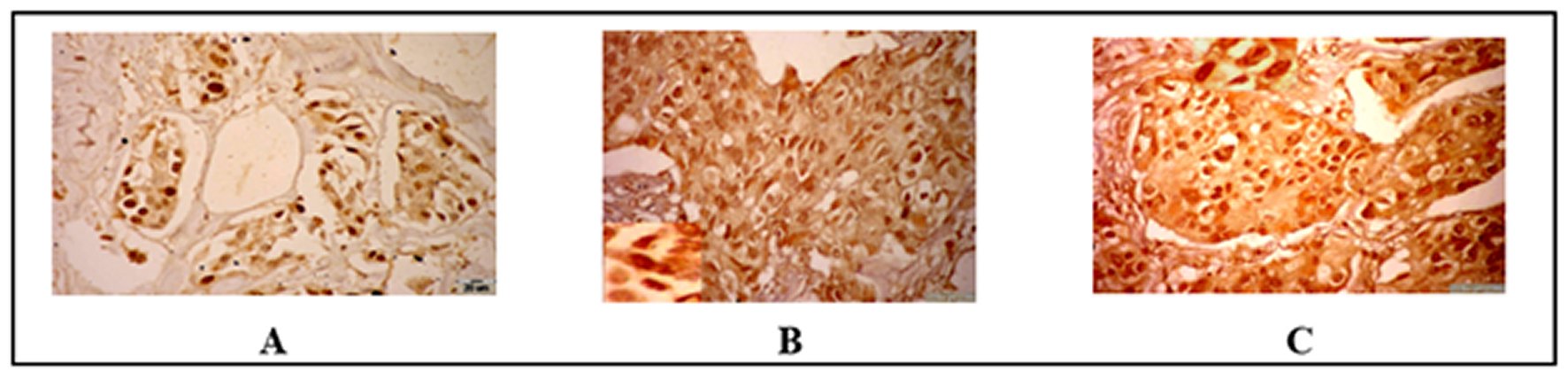 Immunohistochemical results of tested samples (ABC and DAB, BAR=20 m).