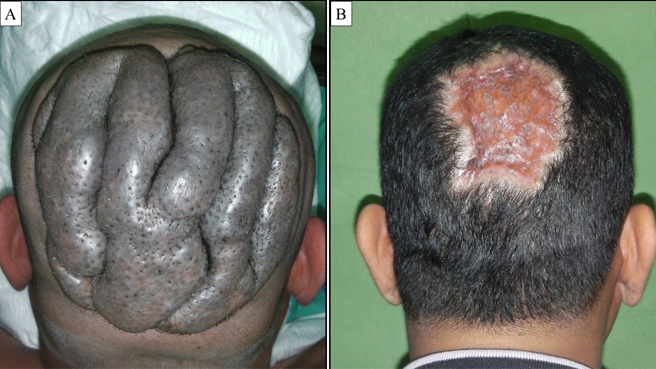 Clinical appearance of the lesion.