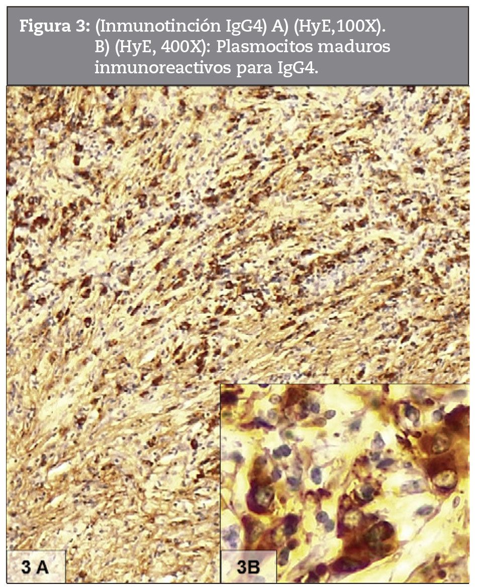 (Inmunotincin IgG4) A) (HyE, 100X).
