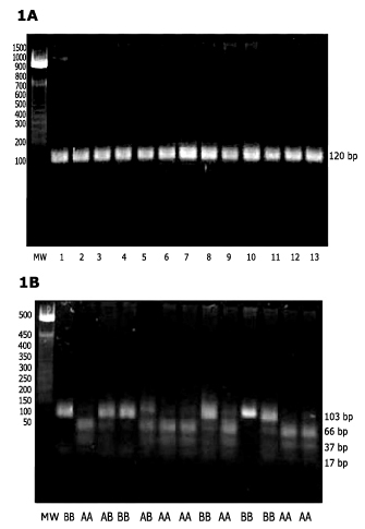 PCR amplification (1A) and RsaI digestion (1B) of the ovine LGB gene. PCR products
of LGB gene were visualized on 2% (w/v) agarose gel. Lane1: DNA ladder; lanes 2-14: ovine samples. RsaI RFPL products were identified on a 2% (w/v) agarose
gel. Lane1: DNA ladder; lanes 2, 5, 9, 11 and 12: BB genotype, lanes 3, 7, 8, 10, 13 and 14: AA genotype; lanes 4 and 6: AB genotype