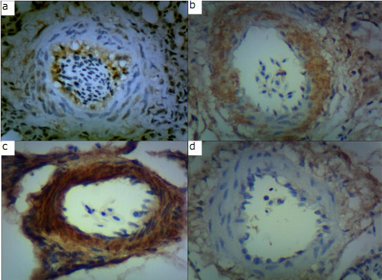 a: ET-1 protein expression in pulmonary arterioles of a chicken: a, maintained under relative normoxia, 
b: exposed to hypobaric hypoxia (non-pulmonary hypertensive), c: pulmonary hypertensive, d: maintained under hypobaric hypoxia (non-pulmonary hypertensive).