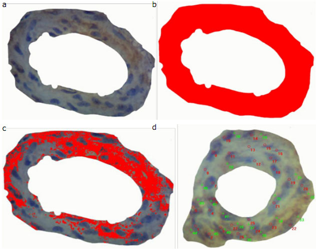 a, Image obtained of the middle muscle layer of an arteriole, before ET-1 expression measurements; b, image obtained of the area occupied by the middle muscle layer of an arteriole; c, results of the area (&micro;m2) obtained after measurement; d, results obtained after counting of cells immunohistochemically expressing ET-1 protein