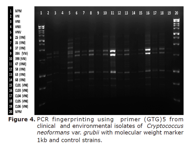Figure 4. PCR fingerprinting using primer (GTG)5 from clinical and environmental isolates of Cryptococcus neoformans var. grubii with molecular weight marker 1kb and control strains.