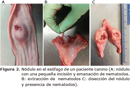 Figura 2. N&oacute;dulo en el es&oacute;fago de un paciente
canino (A: n&oacute;dulo con una peque&ntilde;a incisi&oacute;n y emanaci&oacute;n de nematodos. B:
extracci&oacute;n de nematodos C: disecci&oacute;n del n&oacute;dulo y presencia de nematodos).