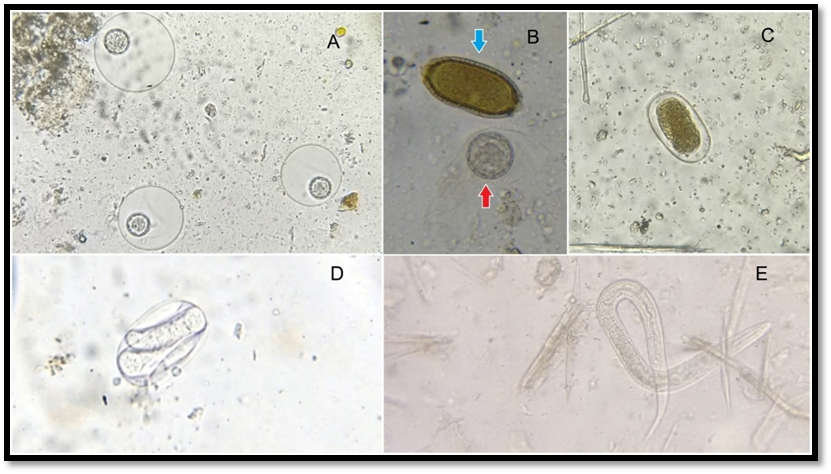 Endoparasites identified in Barranquilla Zoo&rsquo;s snakes objective of 400x A Oocyst of parasites of the Eimeriidae family found in E murinus direct fecal smear B Capillaria sp egg blue arrow and Oocyst of parasites of the Eimeriidae family red arrow found in E murinus direct fecal smear C Nonlarvated egg of nematode of the Strongylida order found in B constrictor flotation exam D Larvated egg of nematode of the Strongylida order found in B constrictor flotation exam E Rhabditiform larvae found in T paraguanae direct fecal smear Source Duran 2016