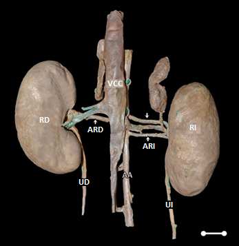 Macrofotograf&iacute;a mostrando la arteria renal izquierda doble en C. thous: VCC-vena cava caudal, AA-aorta abdominal, RD-ri&ntilde;&oacute;n derecho, RI-ri&ntilde;&oacute;n izquierdo, ARD-arteria renal derecha, ARI- arteria renal izquierda (&darr; - arteria renal izquierda craneal; &uarr; arteria renal izquierda caudal), UD- ur&eacute;ter derecho, UI- ur&eacute;ter izquierdo. Barra de escala 1cm.