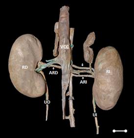 Photomacrography showing the double left renal artery in C thous CVCcaudal vena cava AAabdominal aorta RKright kidney LKleft kidney RRAright renal artery LRAleft renal artery &darr;  cranial left renal artery &uarr; caudal left renal artery RUright ureter LUleft ureter Scale bar 1cm