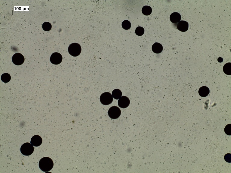 Detection of presumptive Perkinsus sp hipnospores in tissue of Megapitariasqualida by means of the MFTR staining technique 40X Infection intensity in level 2 Mackin&acute;s scale Bar scale  100 μm