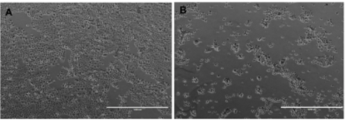 Seguimiento de la proliferaci�n de c�lulas epiteliales dentales de rata cultivadas con SFB a una concentraci�n de