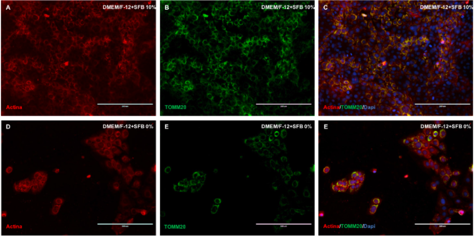 Immunomarking of actin and mitochondrial filaments in rat dental epithelial cells in DMEM / F12 culture media at 10% and 0% FBS. Double marking: actin (red) / mitochondria (green) grown with a concentration of 10% of FBS (A, B, C) and in the absence of FBS (D, E, F). Nucleus colored in blue. DMEM / F12: Dulbecco’s Modified Eagle Medium: Nutrient Mixture F-12. FBS: Fetal Bovine Serum. White bar: 200 m