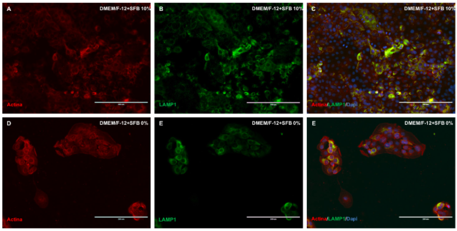 Expression of actin and lysosome filaments in rat dental epithelial cells in DMEM / F12 culture media at 10% and 0% FBS. Double marking: actin (red) / lysosomes (green) grown at a concentration of 10% of FBS (A, B, C) and in the absence of FBS (D, E, F). Nucleus colored in blue. DMEM / F12: Dulbecco’s Modified Eagle Medium: Nutrient Mixture F-12. FBS: Fetal Bovine Serum. White bar: 200 m.