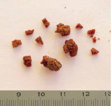 Perkasos 7 pietiniame pagilėjime surastas sutrūkęs gintaro gabaliukas. E. Šatavičiaus nuotrauka