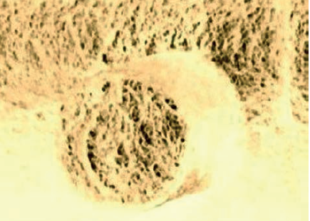 Grafine programa apdorotas dešiniojo kaiščio dugno vaizdas. Išryškėjęs „O“ simbolis