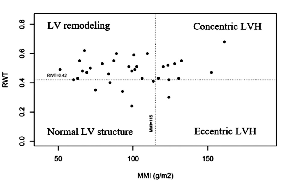 TTE data distribution among men LV – left ventricle LVH – left ventricular hypertrophy RWT – relative wall thickness MMI – myocardial mass index