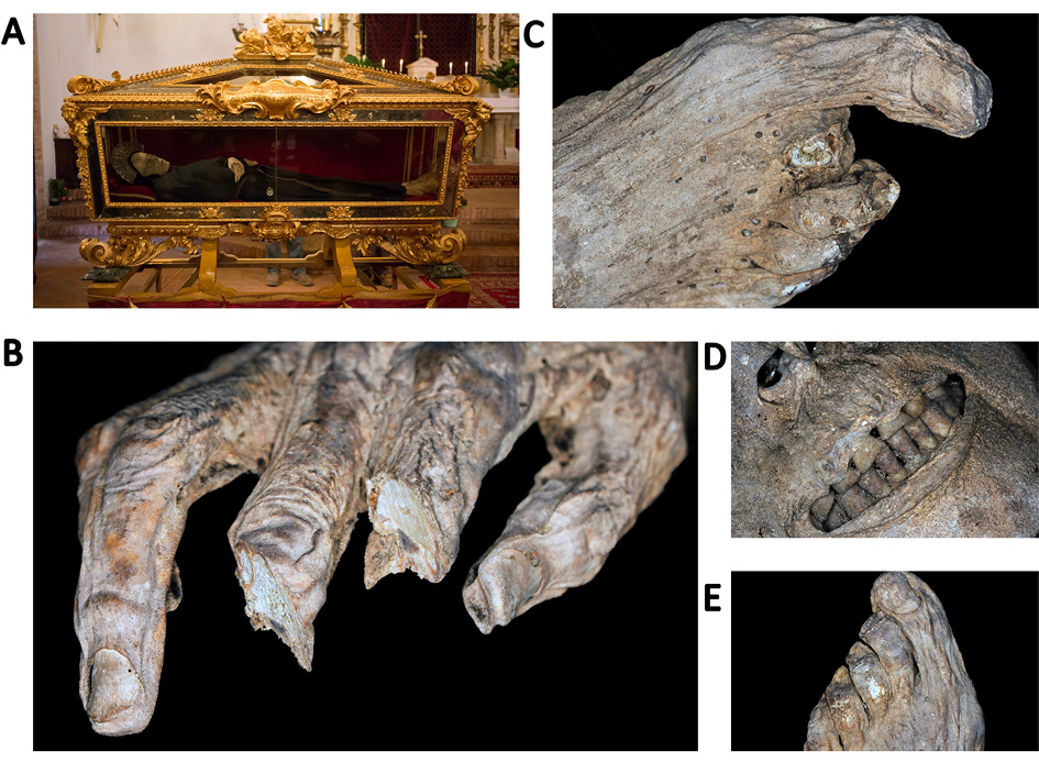 The spontaneously mummified remains believed to belong to the Blessed Antonio of Monticiano, Sienna.